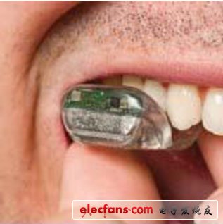 SoundBite牙齿助听系统