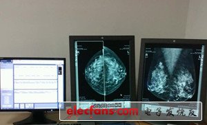 新型医疗X光乳腺成像法 辐射急剧降低