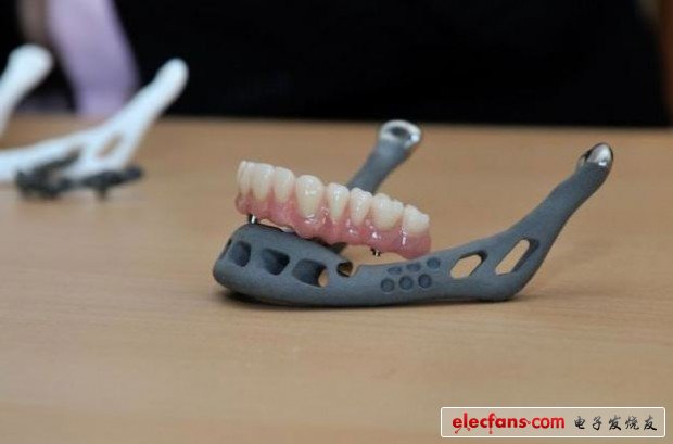 3D打印技术在牙齿上的应用