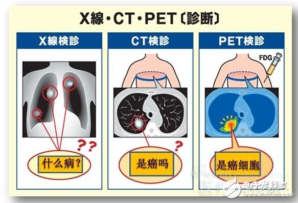PET和PET-CT的区别