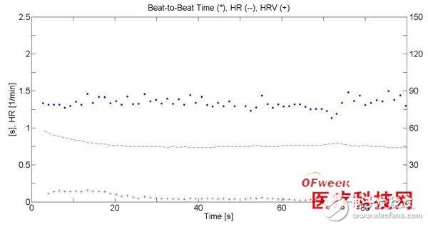 在心搏图测量中加速度传感器有什么作用？