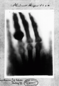 1895年，伦琴发现X射线